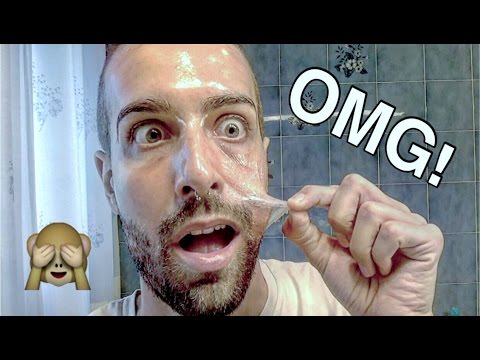 Tutte le stelle con konopushka La crema tedesca da posti di pigmentary