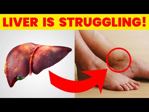 This Is How Your Feet Can Tell You About Your Liver Issues