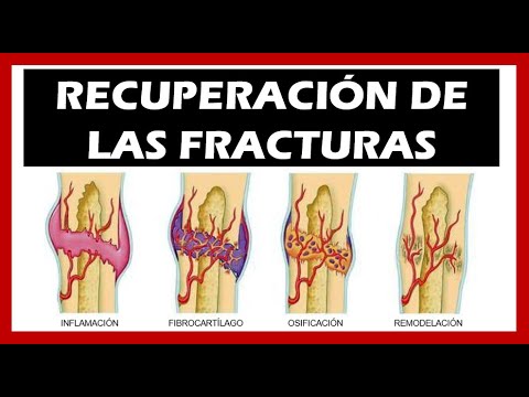 Mal di schiena a sinistra e invia al gluteo Operazioni in Germania, protesi danca