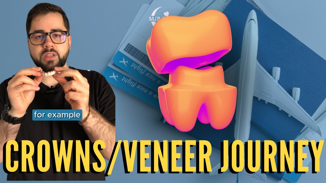 Crown/Veneer Journey | Dental Treatment | MJB CARE