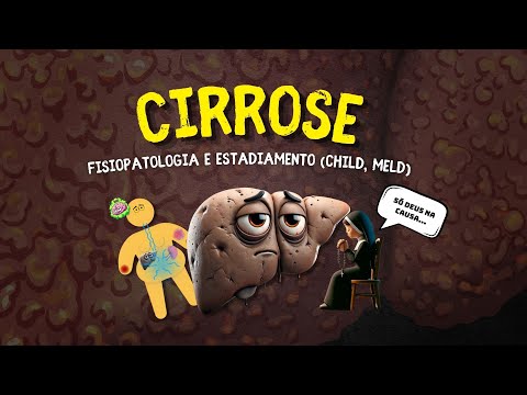 Cirrose: Fisiopatologia e Estadiamento | Aula aberta e gratuita