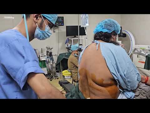 live anesthesia #5# ACL reconstruction surgery #anesthesia #spinal