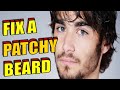 How To Fix A Patchy Beard NATURALLY FAST CHEAPLY At Home