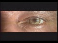 Teaser