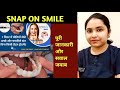 Picture Perfect White Teeth In A Minute SNAP ON SMILE Detail In Hindi