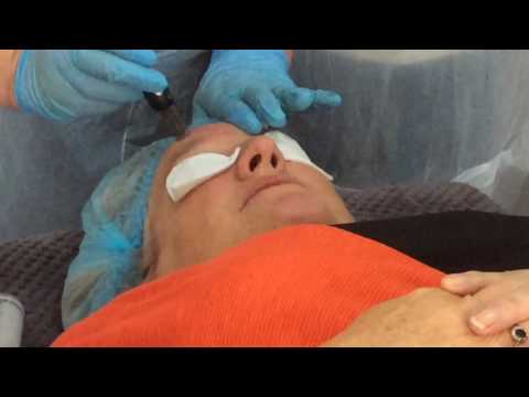 Dermapen™ Training at Jovem Aesthetics.