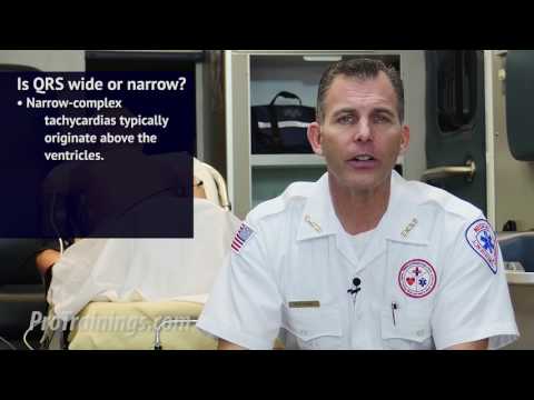 What is Tachycardia?