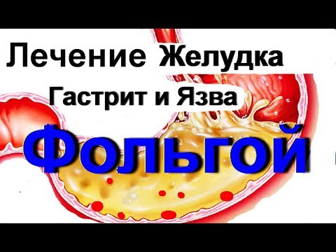 Пермь рентген коленного сустава в Адаптивная гимнастика бубновского для коленных суставов