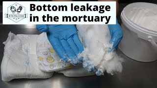 Stopping the leakage from bottoms in the mortuary