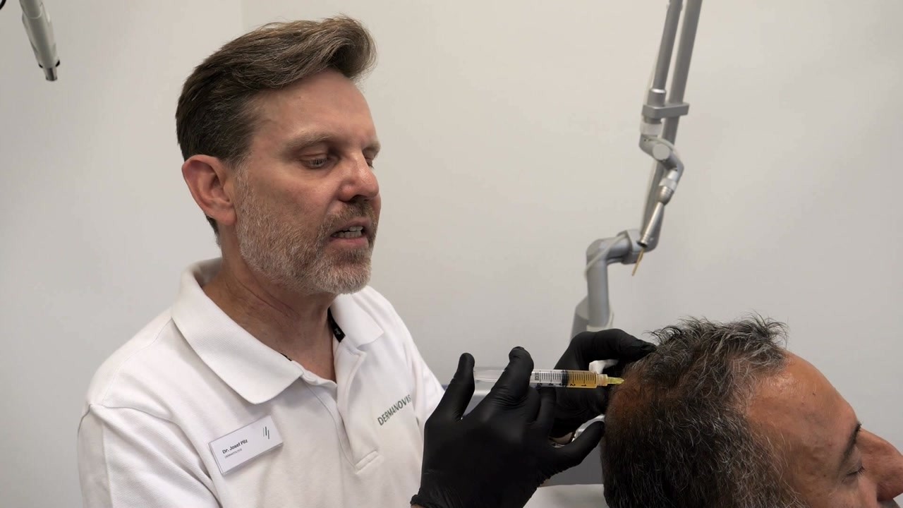 PRP - Eigenbluttherapie bei männlichen Haarausfall