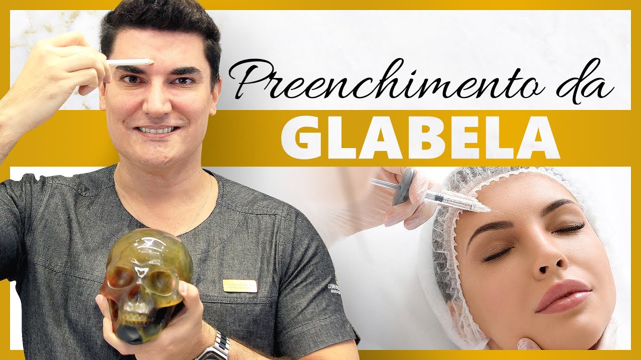 Watch Now Harmonização Facial através do Preenchimento da Glabela com Ácido Hialurônico #acidohialuronico Harmonização Facial através do Preenchimento da Glabela com Ácido Hialurônico #acidohialuronico