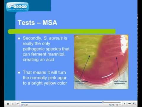 Prostatitis bacteriana enterococo fecalistico Prostatitis bacteriana enterococo fecalistico
