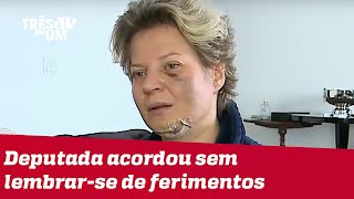 Joice Hasselmann apresenta lesões e diz ter sido vítima de atentado