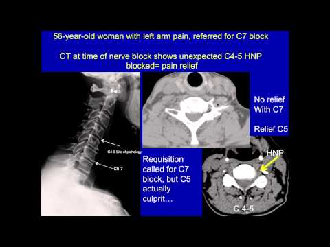 Visualizing Other Causes of Back Pain | UCSF Radiology