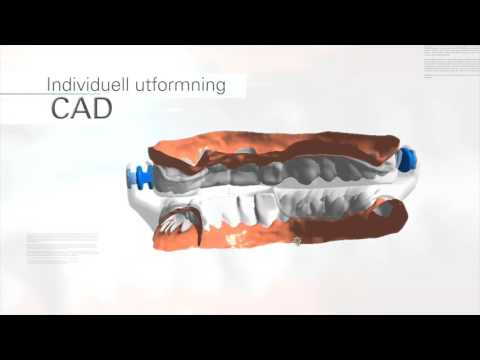 ResMed presenterar Narval CC teknologin