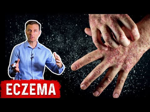 Are ACV Apple Cider Vinegar Gummies Healthy