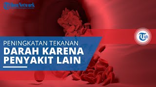 Hipertensi Sekunder, Peningkatan Tekanan Darah yang Disebabkan oleh Kondisi Kesehatan Lain