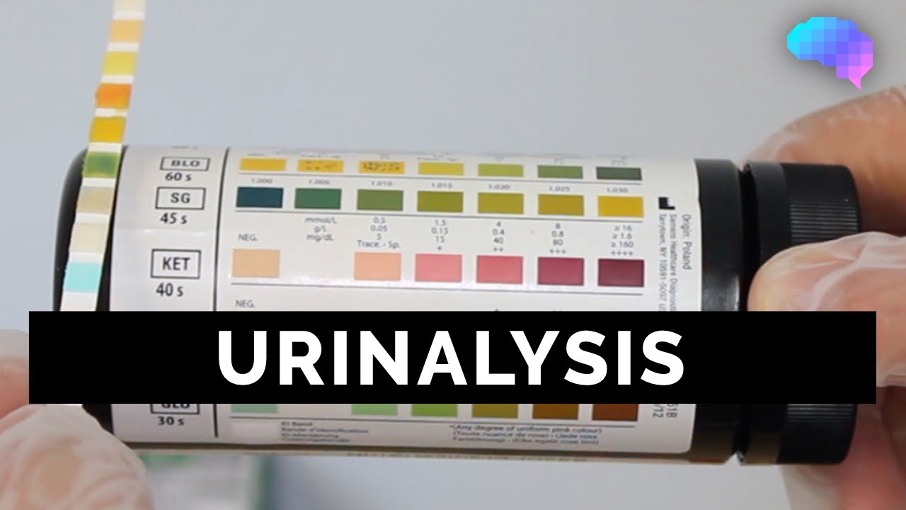 Urinalysis - OSCE Guide