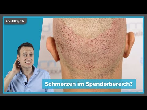 Pain after hair transplantation | Healing process & sensitivity of the donor area