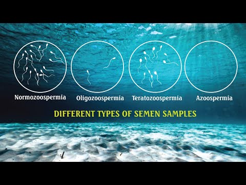 Semen analysis Samples- OLIGOZOOSPERMIA, ASTHENOZOOSPERMIA , TERATOZOOSPERMIA| SPERM COUNT
