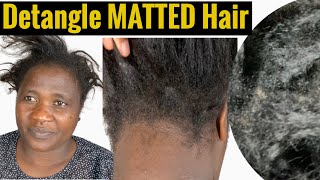 Detangling MATTED Relaxed/ Transitioning Hair Post Braids
