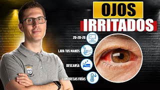 8 REMEDIOS NATURALES PARA LOS OJOS  IRRITADOS