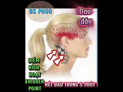 BS PHUC: HẾT ĐAU ĐẦU VỚI ATPT: TERAPIA AMERICANA DE PONTO DE GATILHO (GIẢI PHÓNG ĐIỂM ĐAU KÍCH HOẠT MỸ).