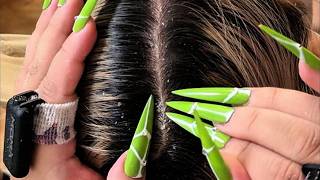 Han’s Gentle Four-Finger Scalp Scratching | Calm Sleep Sounds