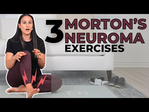 5 Effective Morton's Neuroma Exercises