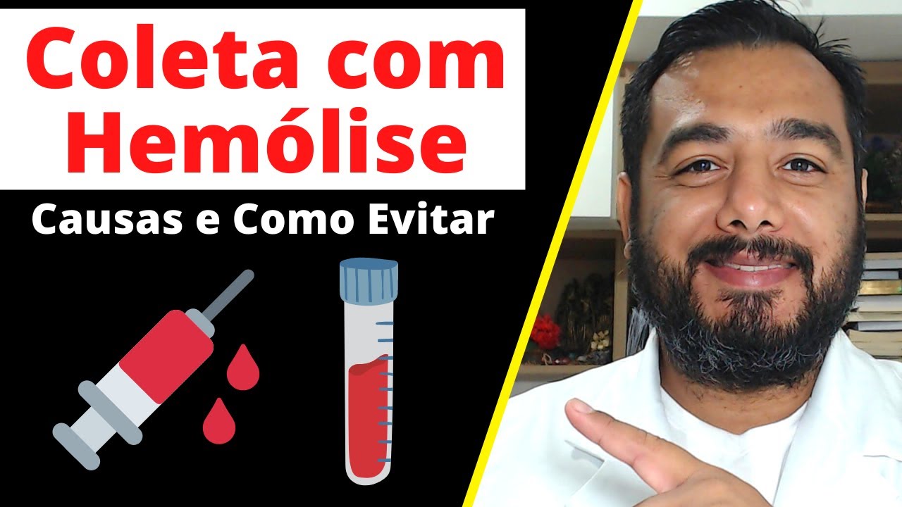 Como Evitar a Hemólise na Coleta de Sangue Venoso? | Causas de Hemólise na Coleta de Sangue