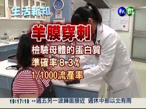 免做羊膜穿刺 驗血檢測唐氏症