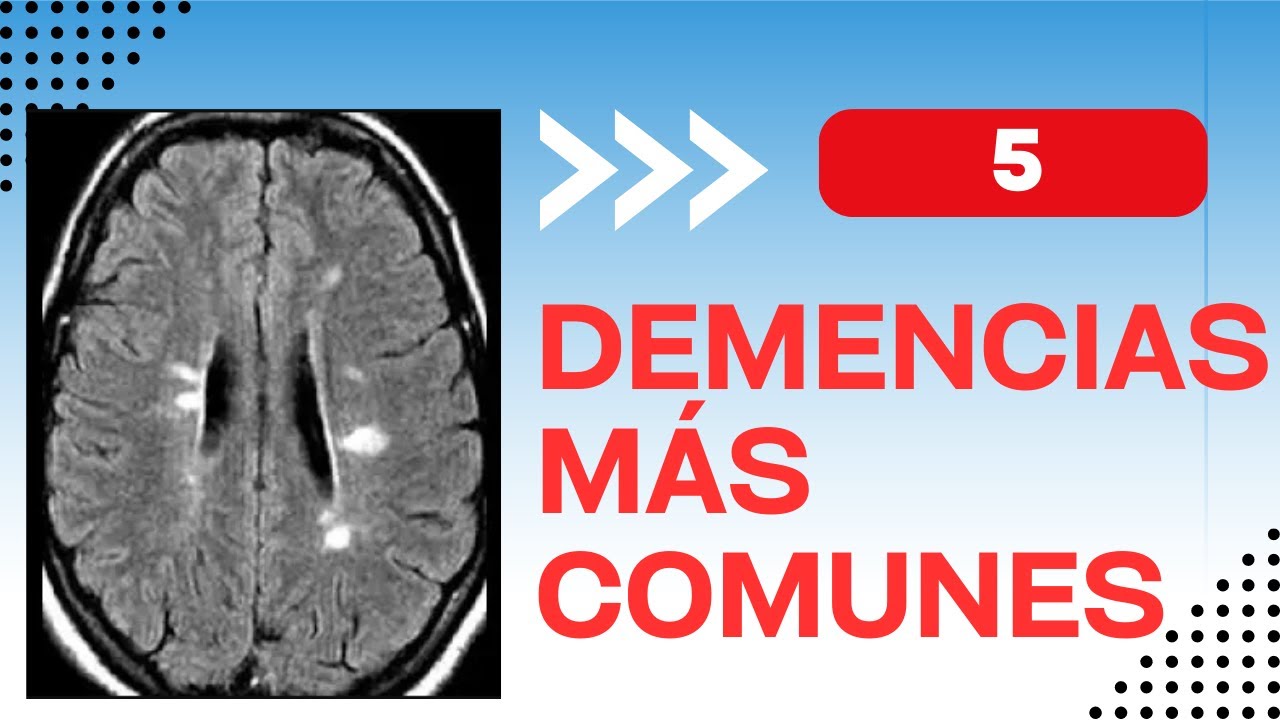 5 demencias más comunes en el mundo