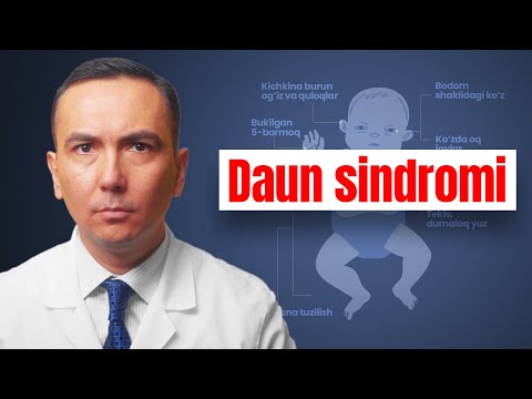 Daun Sindromi: Kelib Chiqishi, Belgilari & Tashxislash!