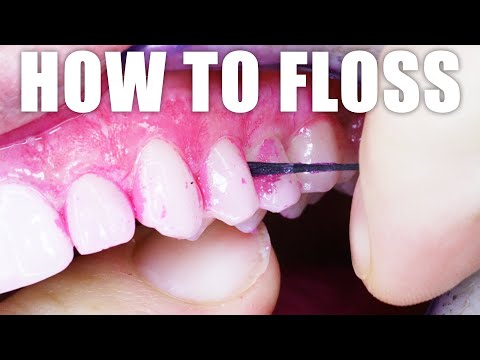Dentist Shows HOW TO FLOSS YOUR TEETH PROPERLY: Correct Dental Flossing Technique! Tutorial Back