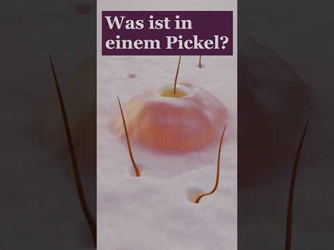 Pus in a pimple | What does the secretion consist of?