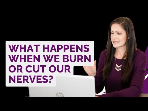 What you need to know about the RFA procedure for pain management