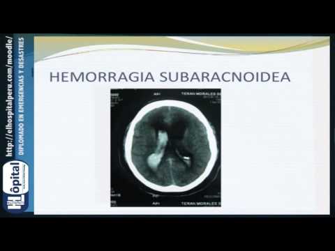 Manejo del Paciente con AVC: Hemorragia Subaracnoidea.