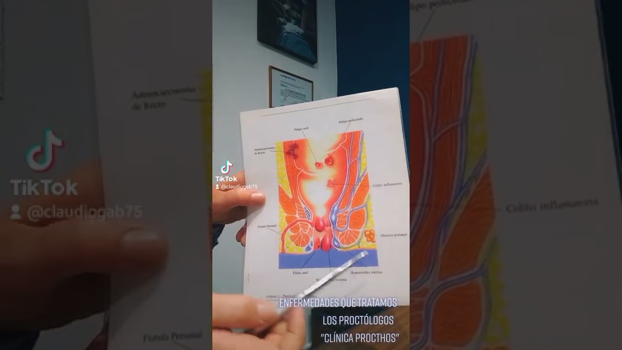 Claudio Gabriel Fermani-41