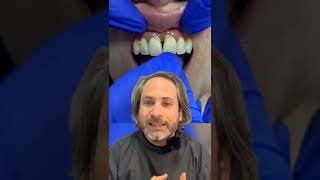 ¿Que puedo hacer si se me MUEVEN los DIENTES y me los tienen que QUITAR MIRA la SOLUCIÓN PERFECTA