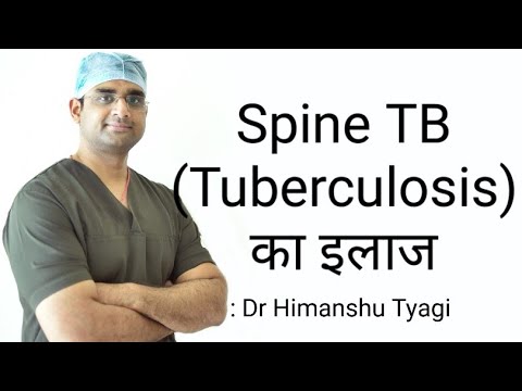 रीढ़ की हड्डी टीबी का इलाज/ Spine tuberculosis treatment