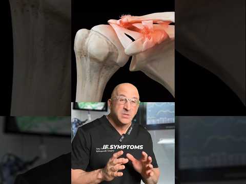 Shoulder Separation 🦾 AC Joint Dislocation #shorts