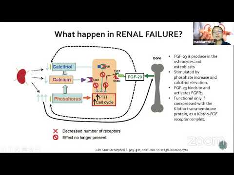 Current Updates on Hyperparathyroidism Management