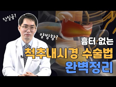 척추내시경 수술, 단일공과 양방향 어떻게 다를까?