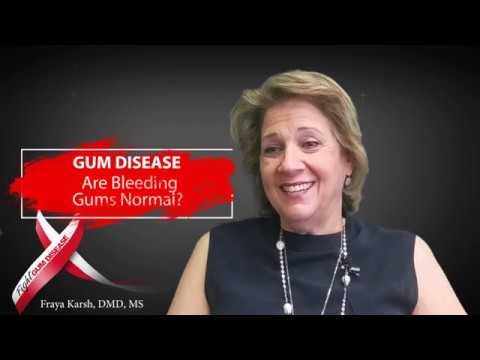 Video preview: Are bleeding gums normal? by Dr. Joseph Nemeth
