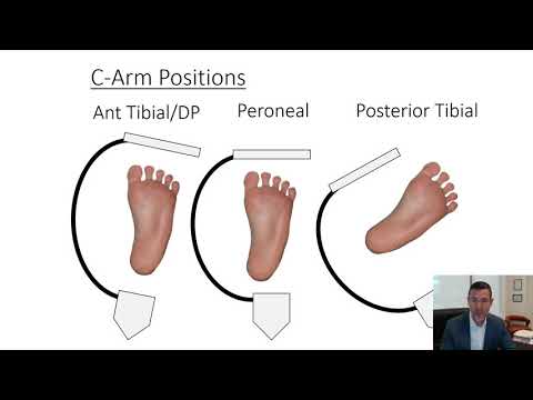 FP CTO Crossing: Step-by-step-Ramon Varcoe, MBBS