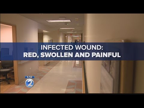 Rare bacteria sends patient to hospital, cause of death under investigation