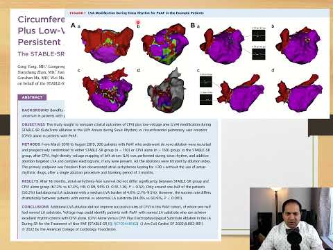 Hirad EP Review  Atrial fibrillation  AA  July 2022