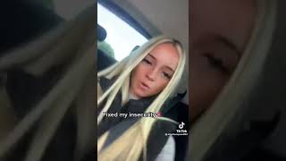 Lip Filler Check | Fixed My Insecurity | Would You Get Lip Injections?