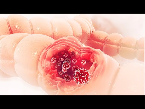 Rak jelita grubego boi się tych roślin