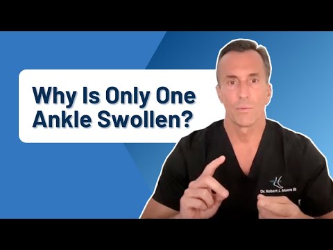 Ankle Arthritis Pain What Exercises Can You Do At Home